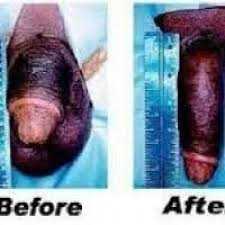TOP UP ,27793478685 Newly Formulated Penis Enlargement Cream //pills in Molteno Morgan's Bay Ngcobo (previously Engcobo) Oyster Bay Queenstown